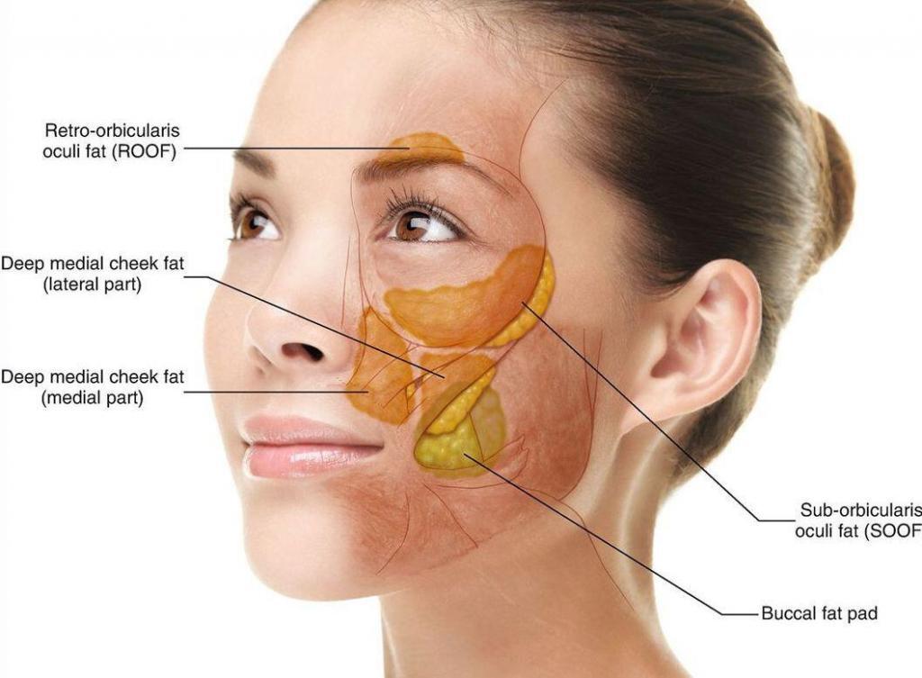 Image of buccal fat pad removal in Mumbai.
