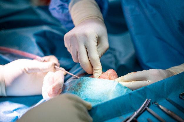 Rhinoplasty in Mumbai, best Rhinoplasty surgeon in Mumbai, Rhinoplasty in India, best Rhinoplasty surgeon in India, best plastic surgeon in India, best plastic surgeon in Mumbai, Dr Siddharth Prakash, Ambrosia Aesthetics, best nose surgeon in india, nose surgery,