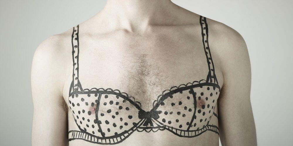 Candidate for gynecomastia surgery in Mumbai.
